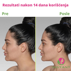 Instant Facelifting™- Maska za zatezanje lica